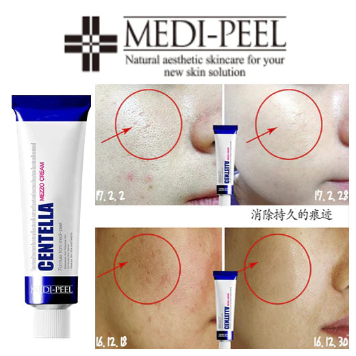 Medi-Peel, Centella Mezzo Cream, 1.01 fl oz (30 ml)