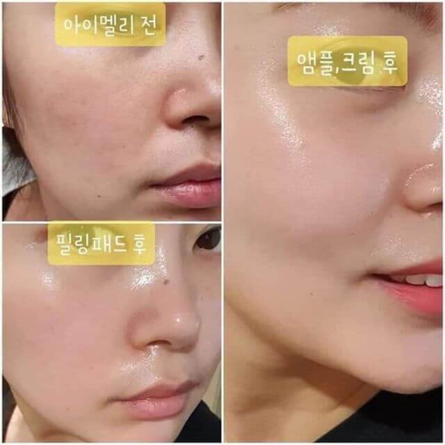 JM COLLAGEN MULTI VITA 38 CAPSULE AMPOULE