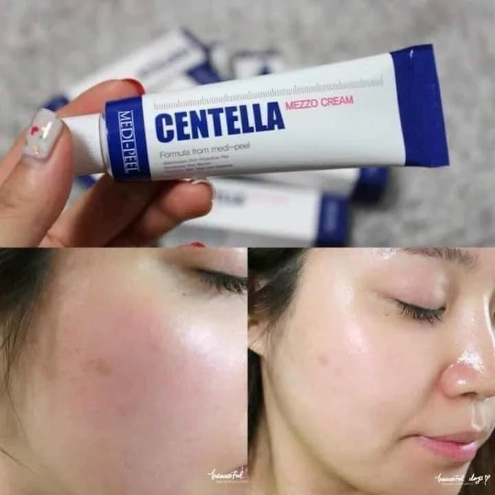 Medi-Peel, Centella Mezzo Cream, 1.01 fl oz (30 ml)