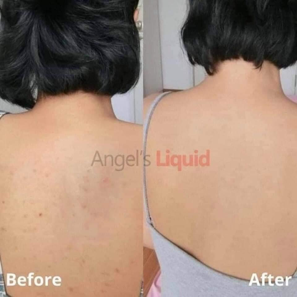 [ANGEL'S LIQUID] Glutathione + Centella Calming Body Mist - GREAT FOR BACK ANCE