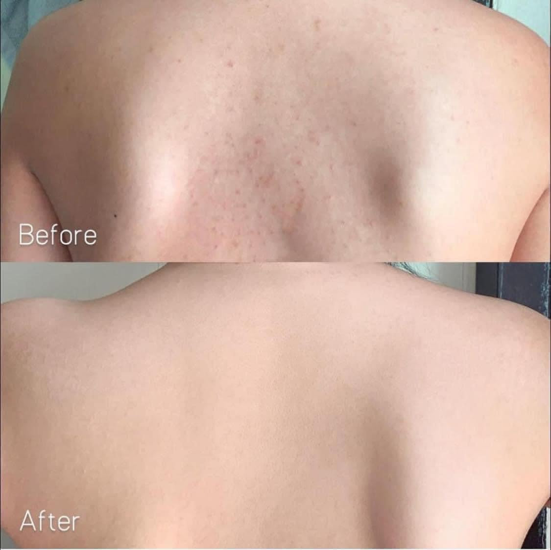 half-life of ipamorelin CJC-1295/Ipamorelin Benefits, Side Effects, and Cost: The Complete Patient Guide half-life of ipamorelin CJC-1295/Ipamorelin Benefits, Side Effects, and Cost: The Complete Patient Guide